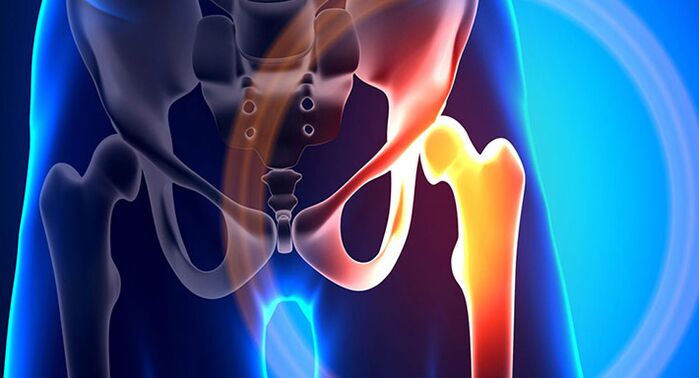 Боль в бедре – симптом многих различных патологий
